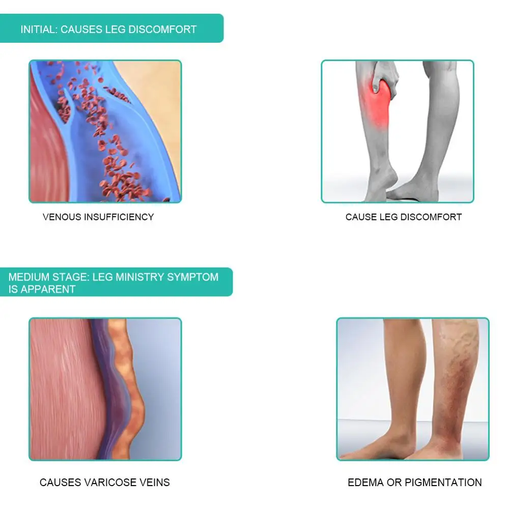 1 para medyczne skarpetki ucis – Compression Sock Medical recenzja i cena