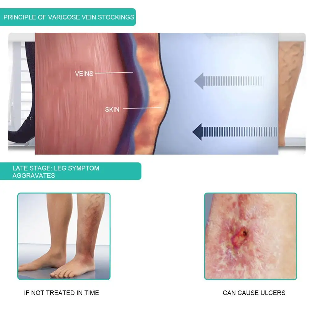 1 para medyczne skarpetki ucis – Compression Sock Medical recenzja i cena
